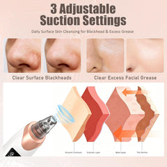 Blackhead Remover Machine
